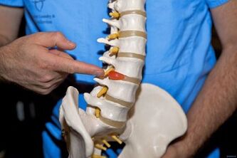 Why does the back in the lower back hurt and what to do is