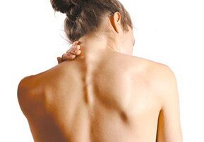 How cervical osteochondrosis manifests itself