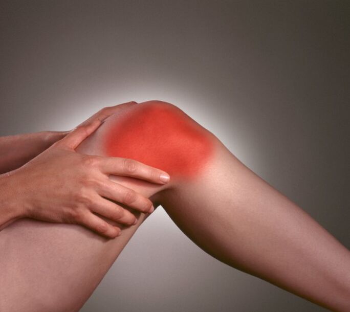 Inflammation in the knee joint with osteoarthritis