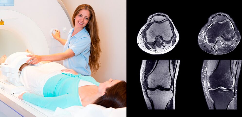 Knee joint diagnosis