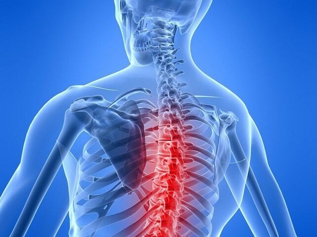 Osteochondrosis of the thoracic spine