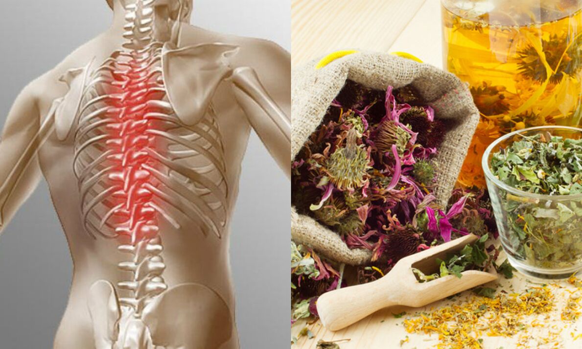 Osteochondrosis of the throat folk methods