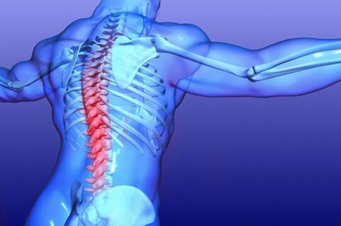 Osteochondrosis of the lumbar spine