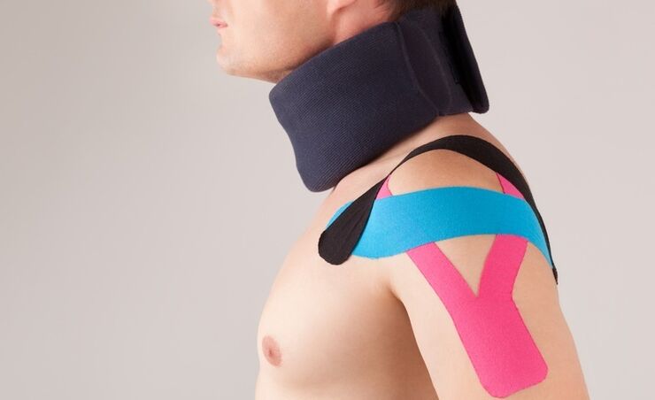 During the acute phase of cervical osteochondrosis, a special collar should be worn