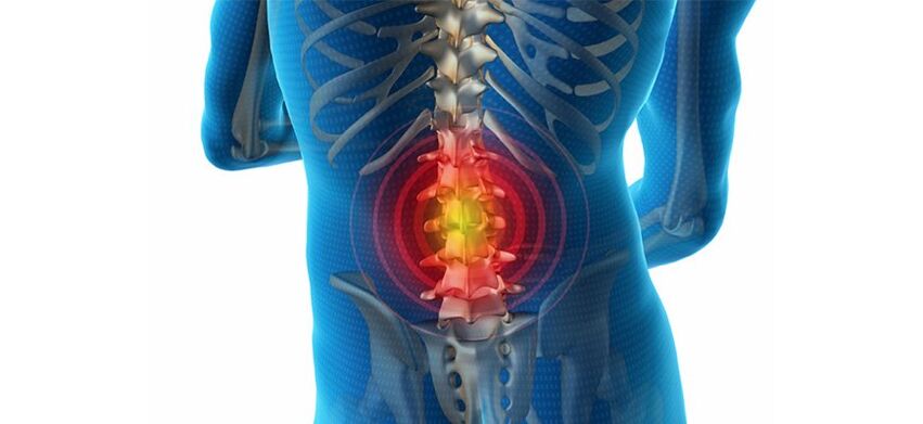 Methods for diagnosing back pain